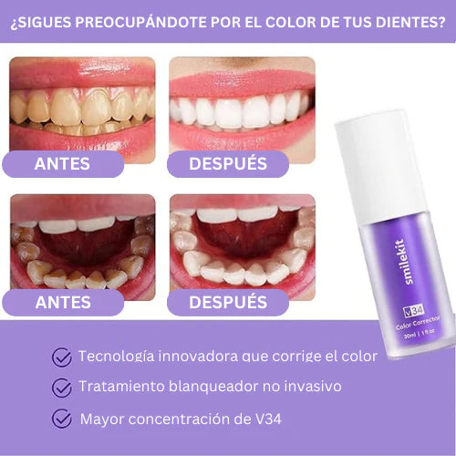 DentisBlanco V34 - Blanqueador dental